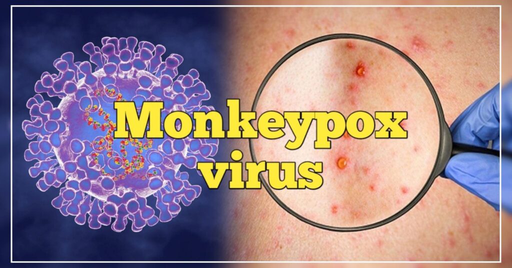 Alert regarding Monkeypox in Uttarakhand too. Hillvani News